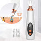 Deep Clean Pore Vacuum Device